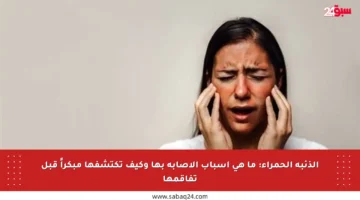 الذئبة الحمراء: ما هي أسباب الإصابة بها وكيف تكتشفها مبكراً قبل تفاقمها